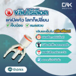 ขลิบหนังหุ้มปลายไร้เลือด แบบใช้เครื่องมืออัตโนมัติ